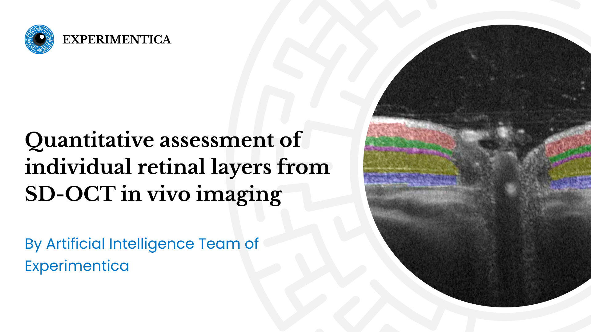 Quantitative assessment of individual retinal layers from SD-OCT in vivo imaging